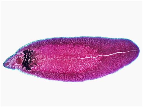 Fasciola Hepatica: Een Lever-Lichte Trematode Met Voorliefde voor Weidedieren!